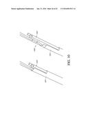 ADJUSTABLE ENDOLUMENAL IMPLANT FOR RESHAPING THE MITRAL VALVE ANNULUS diagram and image