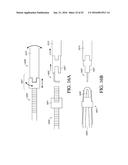 ADJUSTABLE ENDOLUMENAL IMPLANT FOR RESHAPING THE MITRAL VALVE ANNULUS diagram and image