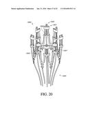 ADJUSTABLE ENDOLUMENAL IMPLANT FOR RESHAPING THE MITRAL VALVE ANNULUS diagram and image