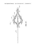 ADJUSTABLE ENDOLUMENAL IMPLANT FOR RESHAPING THE MITRAL VALVE ANNULUS diagram and image