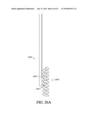 ADJUSTABLE ENDOLUMENAL IMPLANT FOR RESHAPING THE MITRAL VALVE ANNULUS diagram and image