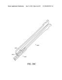 ADJUSTABLE ENDOLUMENAL IMPLANT FOR RESHAPING THE MITRAL VALVE ANNULUS diagram and image