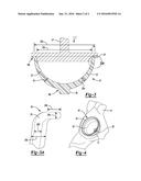 ACETABULAR PROSTHESIS LINER diagram and image