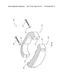 INTERVERTEBRAL SPACERS AND RELATED METHODS AND INSTRUMENTS diagram and image