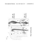 METHODS AND APPARATUSES FOR TREATING VESSELS diagram and image