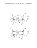 METHODS AND APPARATUSES FOR TREATING VESSELS diagram and image