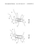 METHODS AND APPARATUSES FOR TREATING VESSELS diagram and image