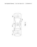 METHODS AND APPARATUSES FOR TREATING VESSELS diagram and image