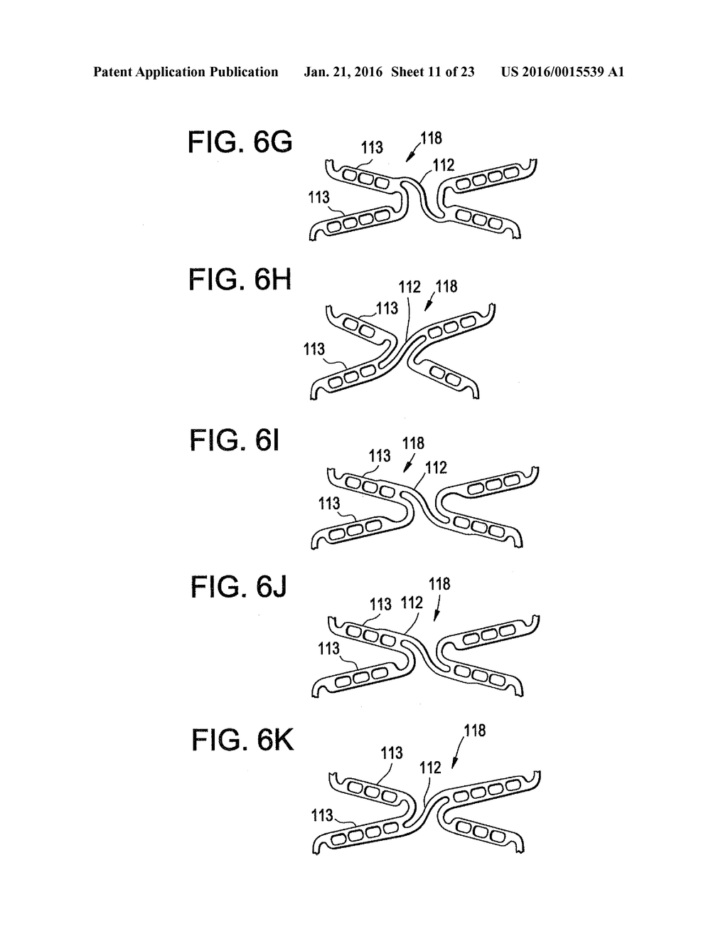 FLEXIBLE STENT DESIGN - diagram, schematic, and image 12