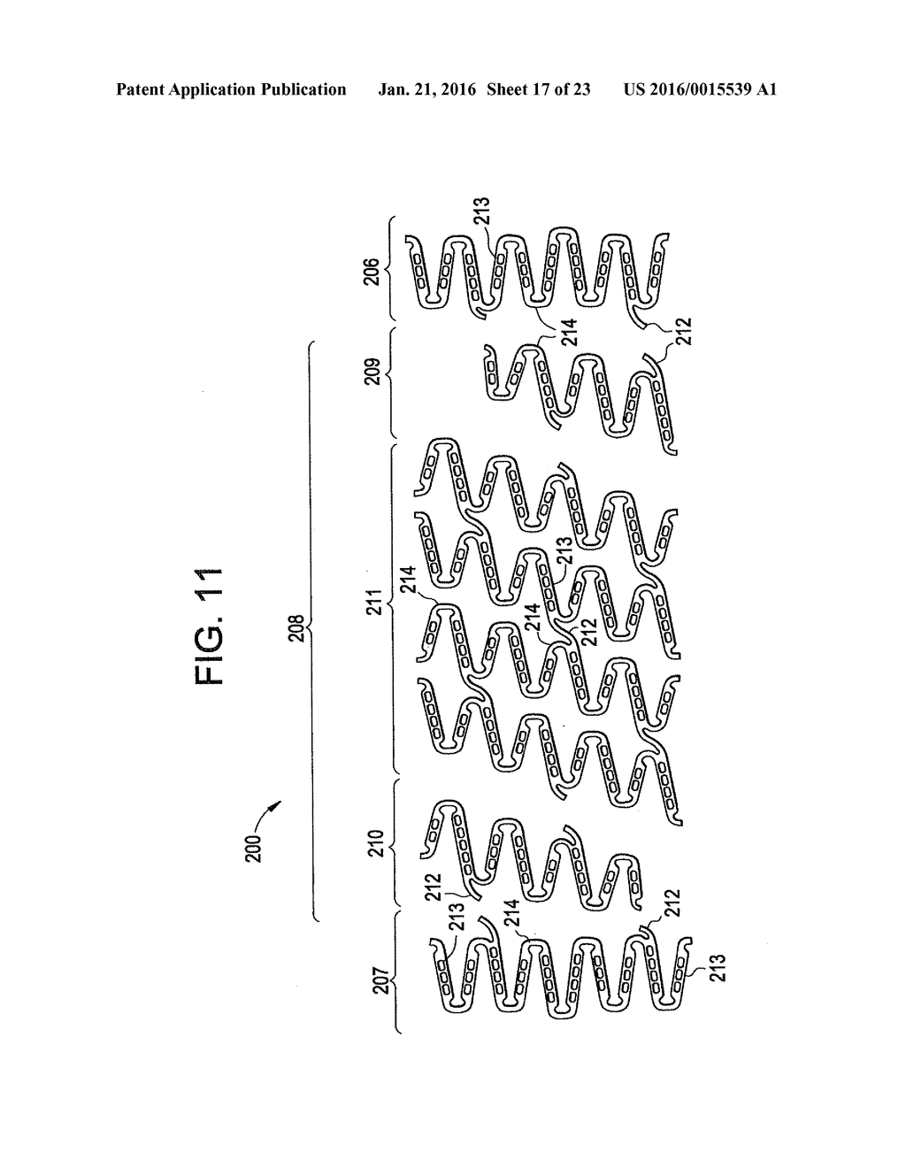 FLEXIBLE STENT DESIGN - diagram, schematic, and image 18