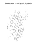 HIGHLY FLEXIBLE STENT diagram and image