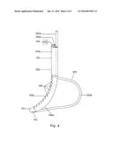 GASTRIC TUBES AND METHODS OF USE diagram and image