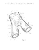 HIP SPICA CAST AND UNDERGARMENT FOR USE WITH HIP SPICA CAST diagram and image
