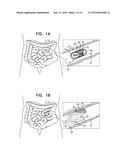 ENHANCED DRUG DELIVERY PILL diagram and image