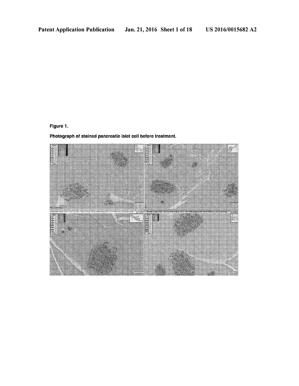 TETRAHYDROCANNABIVARIN (THCV) FOR USE IN THE PROTECTION OF PANCREATIC     ISLET CELLS - diagram, schematic, and image 02