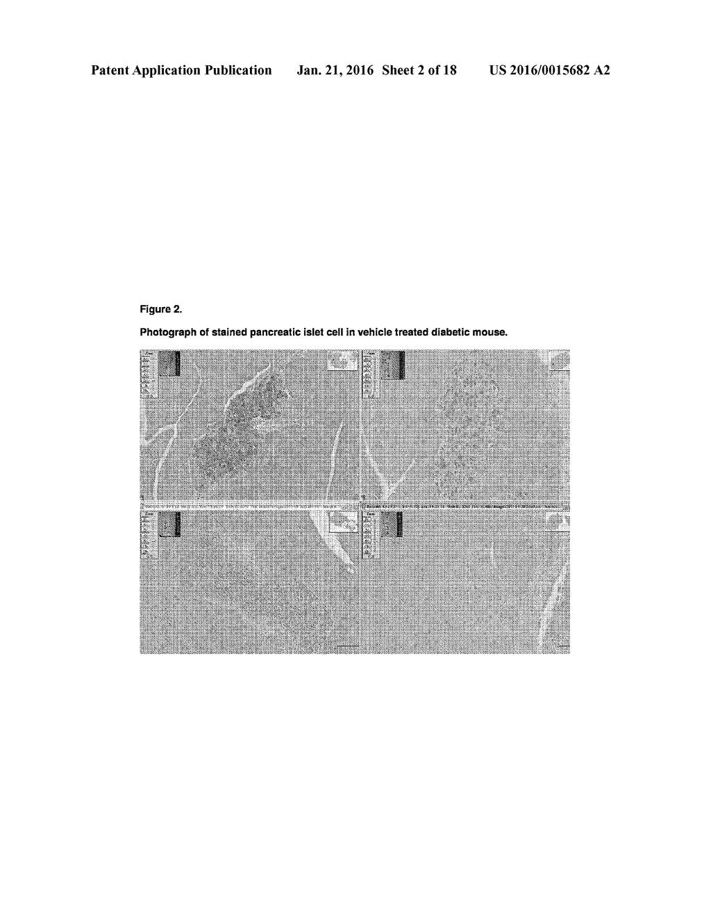 TETRAHYDROCANNABIVARIN (THCV) FOR USE IN THE PROTECTION OF PANCREATIC     ISLET CELLS - diagram, schematic, and image 03