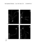 TRANSCRANIAL BURST ELECTROSTIMULATION APPARATUS AND ITS APPLICATIONS diagram and image