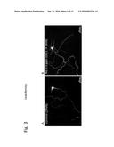 TRANSCRANIAL BURST ELECTROSTIMULATION APPARATUS AND ITS APPLICATIONS diagram and image