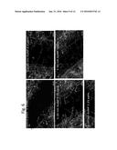 TRANSCRANIAL BURST ELECTROSTIMULATION APPARATUS AND ITS APPLICATIONS diagram and image