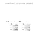 SorCS1-Like Agent for Use in the Treatment of Insulin Resistance and     Diseases Related Thereto diagram and image