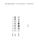 SorCS1-Like Agent for Use in the Treatment of Insulin Resistance and     Diseases Related Thereto diagram and image