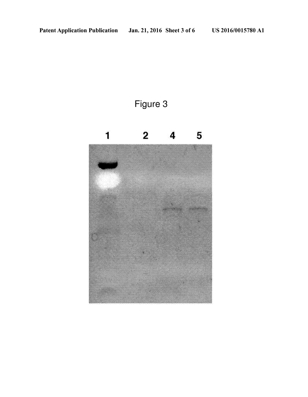 Therapeutic Modulation of Ocular Surface Lubrication - diagram, schematic, and image 04