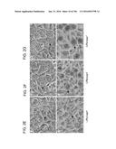 ATTENUATED CHLAMYDIA VACCINE diagram and image