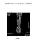 DIRECT PRESSURE-MEDIATED INTRA-BONE DELIVERY SYSTEM FOR CELLULAR     THERAPEUTICS diagram and image