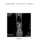 DIRECT PRESSURE-MEDIATED INTRA-BONE DELIVERY SYSTEM FOR CELLULAR     THERAPEUTICS diagram and image