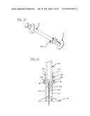 Method and Apparatus for Delivering a Therapeutic Substance Through an     Injection Port diagram and image