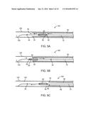 VASCULAR ACCESS SYSTEM AND METHOD OF USE diagram and image