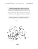 SYSTEM FOR DECREASING THE BLOOD FLOW OF A TARGETED ORGAN S ARTERY WITH AN     ELECTRICAL STIMULATION diagram and image