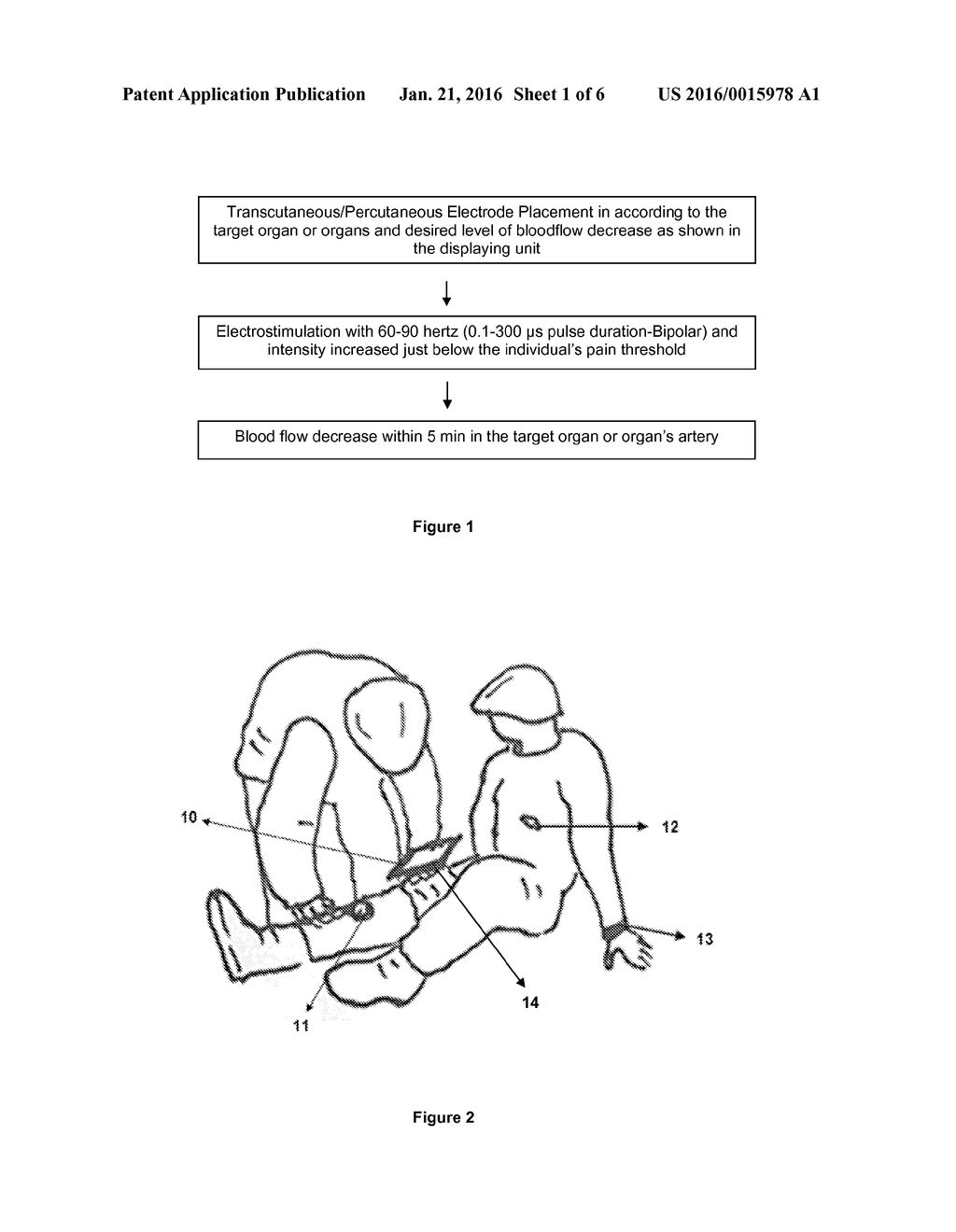 SYSTEM FOR DECREASING THE BLOOD FLOW OF A TARGETED ORGAN'S ARTERY WITH AN     ELECTRICAL STIMULATION - diagram, schematic, and image 02