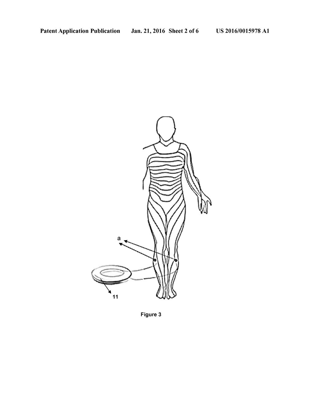 SYSTEM FOR DECREASING THE BLOOD FLOW OF A TARGETED ORGAN'S ARTERY WITH AN     ELECTRICAL STIMULATION - diagram, schematic, and image 03