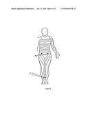 SYSTEM FOR DECREASING THE BLOOD FLOW OF A TARGETED ORGAN S ARTERY WITH AN     ELECTRICAL STIMULATION diagram and image