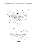 IRRIGATION SPRINKLER diagram and image