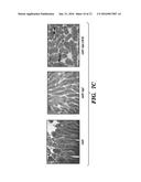 VIBRO-BASED DELIVERY SYSTEM AND IMMUNE SUPPRESSION diagram and image