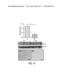 METHODS AND COMPOSITIONS WITH IMMUNE THERAPY FOR TREATMENT OF DEMENTIA diagram and image