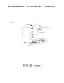 SELECTIVE TARGETING OF CANCER STEM CELLS diagram and image