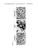 TUMOR-SELECTIVE E1A  AND E1B MUTANTS diagram and image