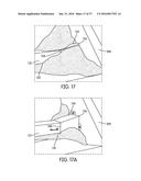 Spreader diagram and image