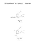 ELASTOMERIC GASKET HAVING A FOAM METAL SKELETAL MEMBER diagram and image