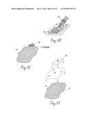 ELASTOMERIC GASKET HAVING A FOAM METAL SKELETAL MEMBER diagram and image