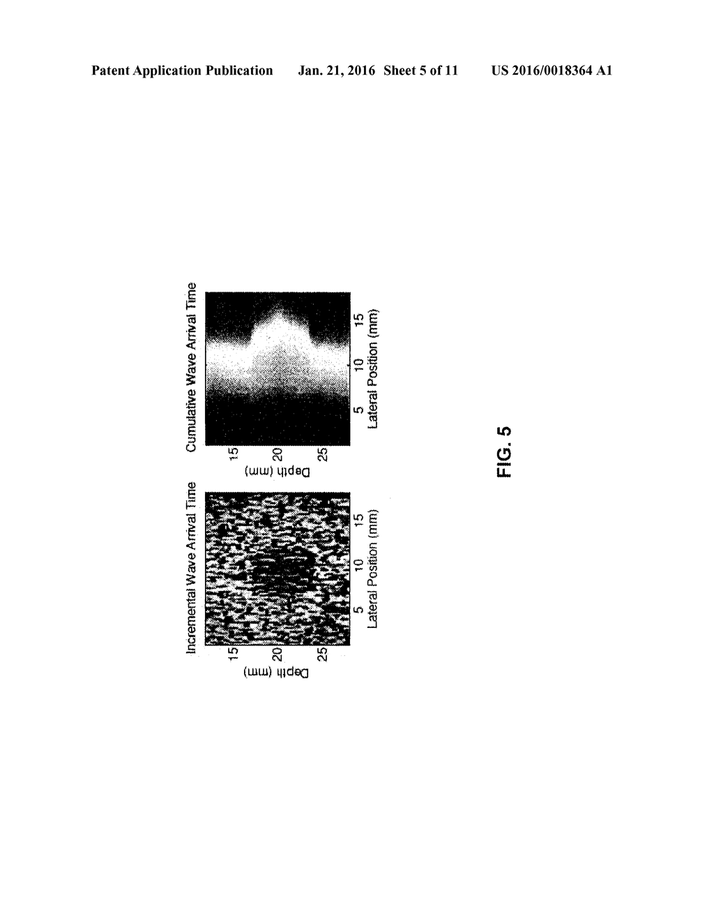 METHODS, SYSTEMS AND COMPUTER PROGRAM PRODUCTS FOR ESTIMATING SHEAR WAVE     SPEED USING STATISTICAL INFERENCE - diagram, schematic, and image 06