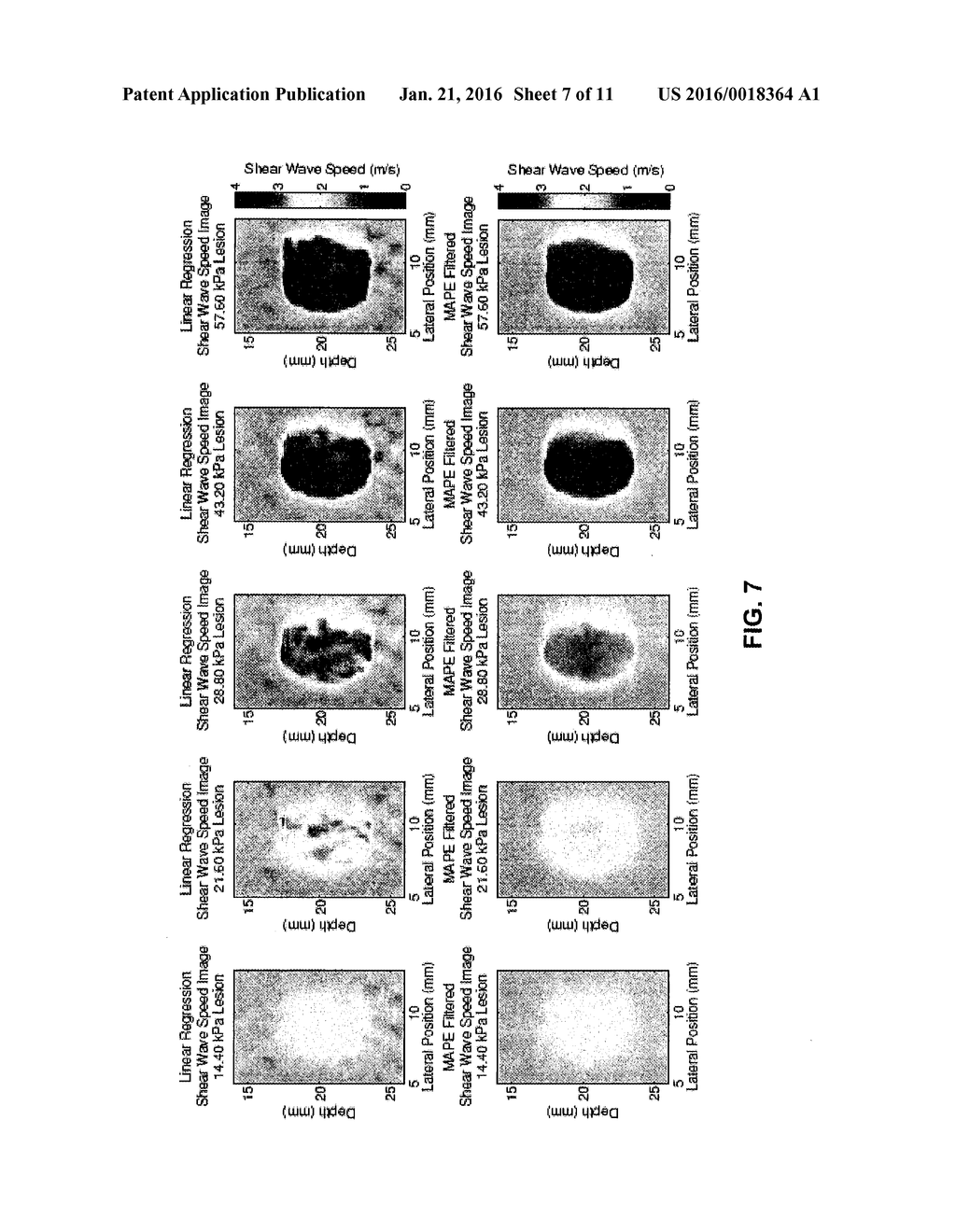 METHODS, SYSTEMS AND COMPUTER PROGRAM PRODUCTS FOR ESTIMATING SHEAR WAVE     SPEED USING STATISTICAL INFERENCE - diagram, schematic, and image 08