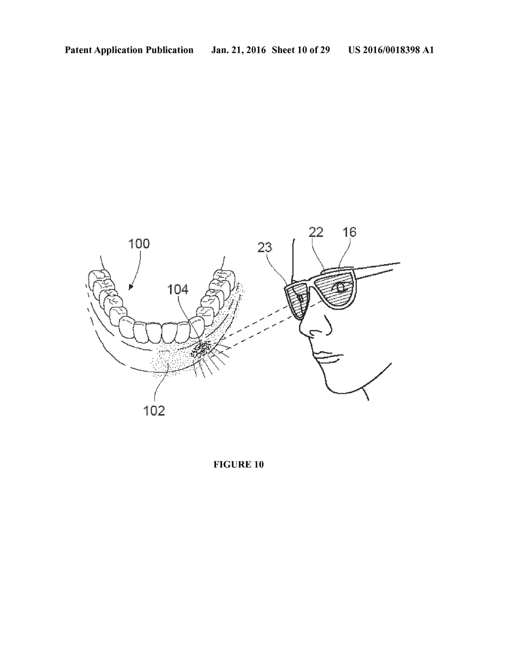 COMPOSITIONS AND METHODS FOR DETECTING ORAL NEOPLASM - diagram, schematic, and image 11