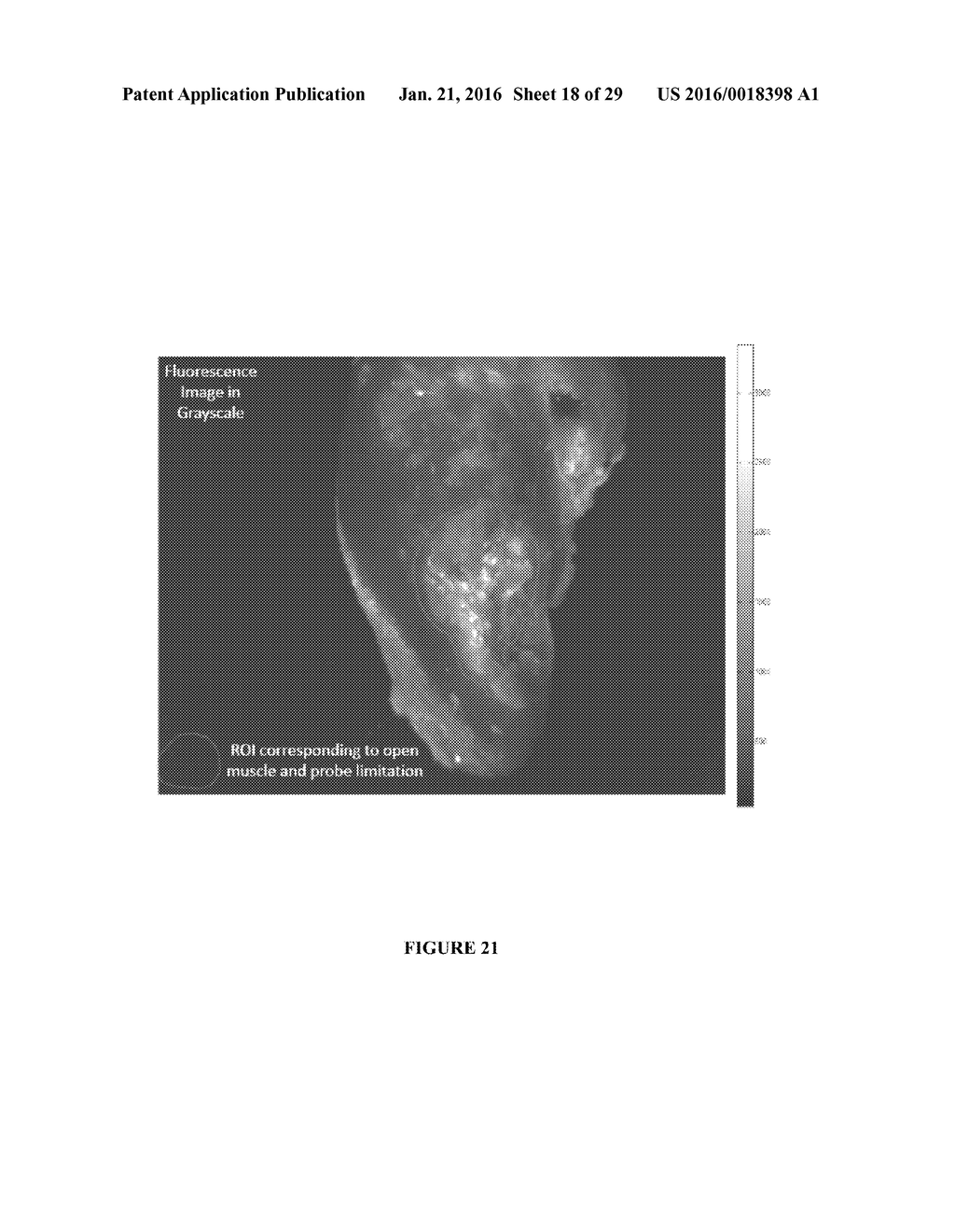 COMPOSITIONS AND METHODS FOR DETECTING ORAL NEOPLASM - diagram, schematic, and image 19