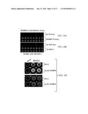 SAB as a Biomarker for Degenerative Diseases and Therapeutic Sensitivity     in Cancers diagram and image