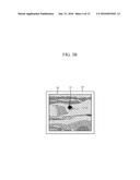 APPARATUS AND METHOD FOR SUPPORTING COMPUTER AIDED DIAGNOSIS (CAD) BASED     ON PROBE SPEED diagram and image