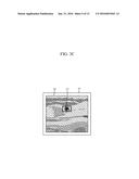 APPARATUS AND METHOD FOR SUPPORTING COMPUTER AIDED DIAGNOSIS (CAD) BASED     ON PROBE SPEED diagram and image